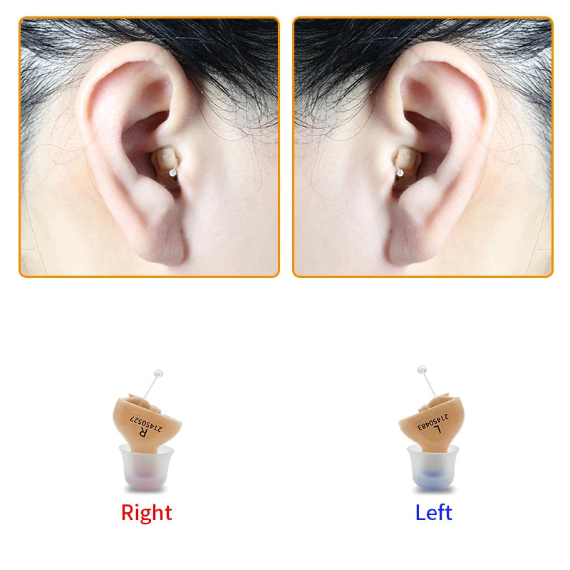 Sound amplifier worn in the ear